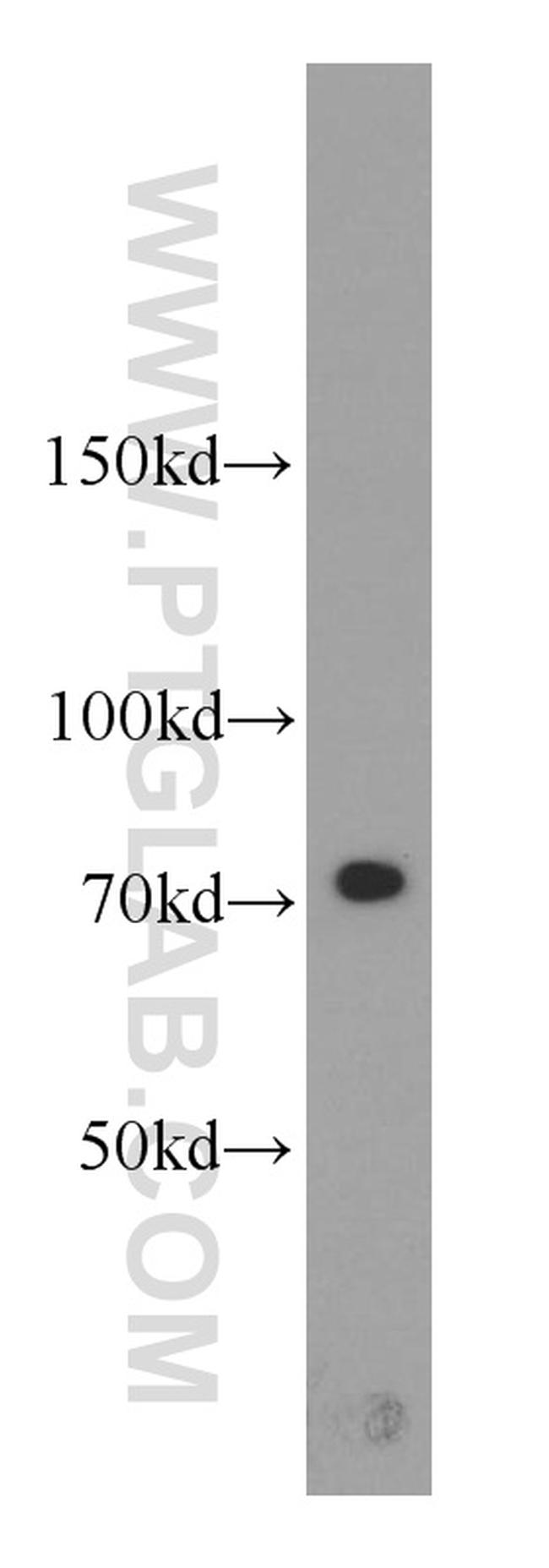 Calpain 1 Antibody in Western Blot (WB)