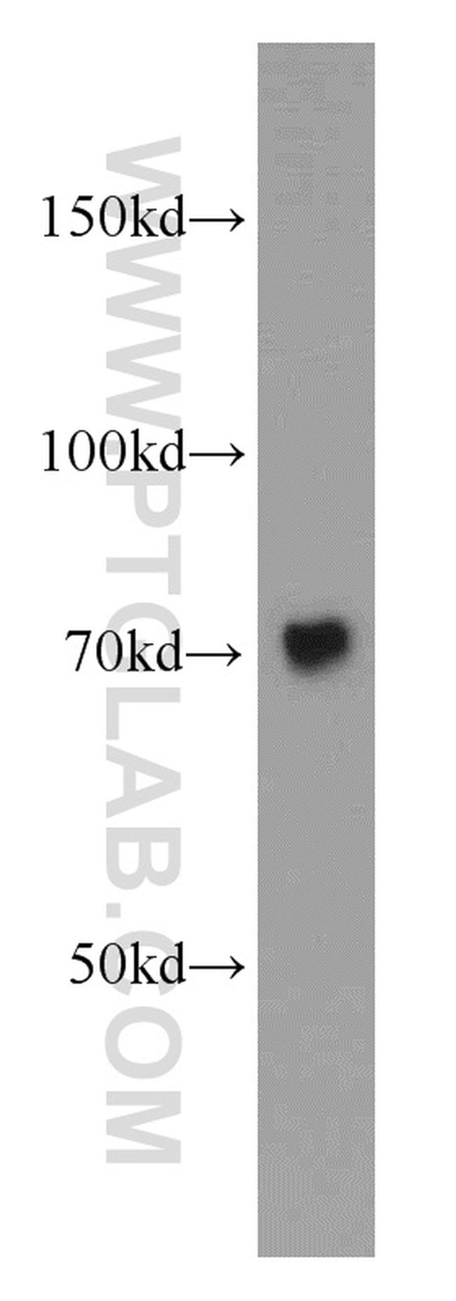 Calpain 1 Antibody in Western Blot (WB)