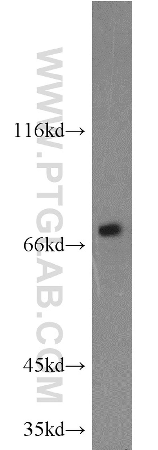 Calpain 1 Antibody in Western Blot (WB)