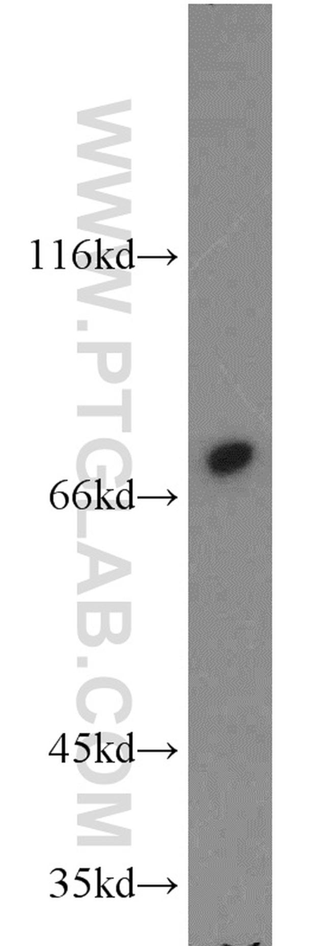 Calpain 1 Antibody in Western Blot (WB)