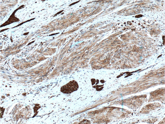 Calpain 1 Antibody in Immunohistochemistry (Paraffin) (IHC (P))