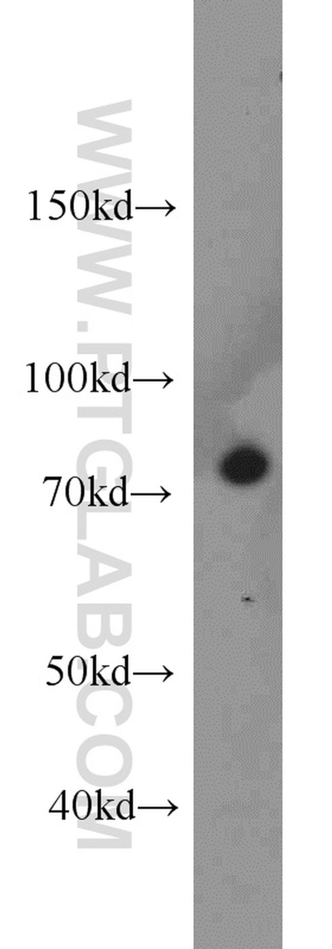 Calpain 1 Antibody in Western Blot (WB)