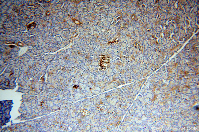 MAOA Antibody in Immunohistochemistry (Paraffin) (IHC (P))