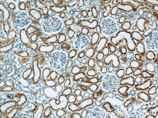 MAOA Antibody in Immunohistochemistry (Paraffin) (IHC (P))