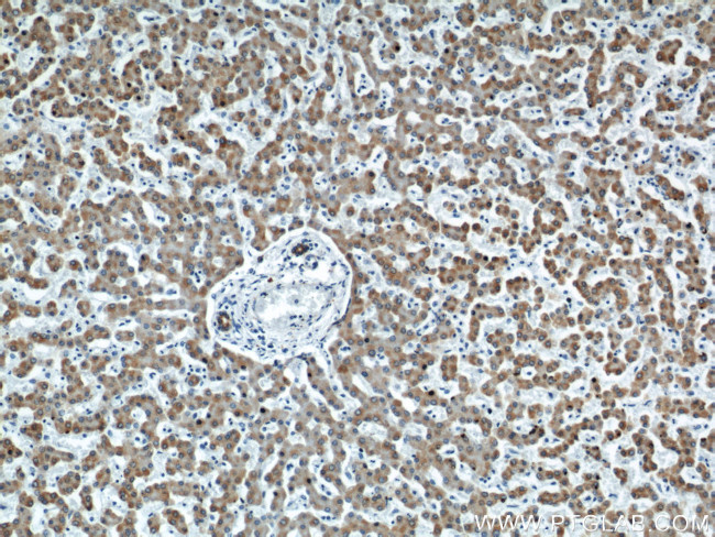 MAOA Antibody in Immunohistochemistry (Paraffin) (IHC (P))