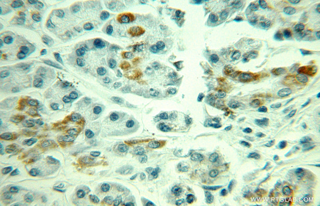 MAOA Antibody in Immunohistochemistry (Paraffin) (IHC (P))