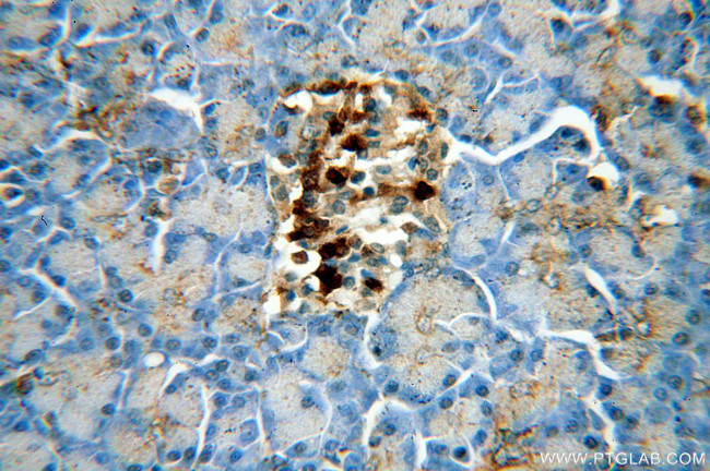 MAOA Antibody in Immunohistochemistry (Paraffin) (IHC (P))