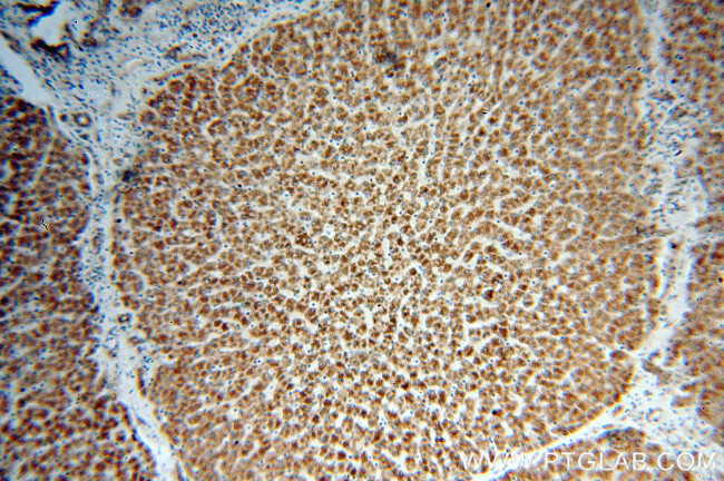 MAOA Antibody in Immunohistochemistry (Paraffin) (IHC (P))