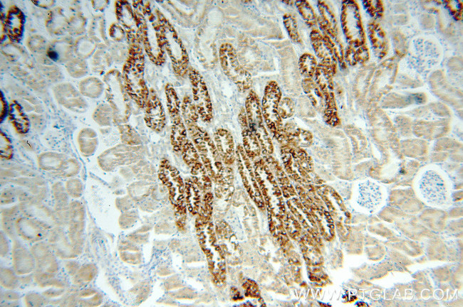 MAOA Antibody in Immunohistochemistry (Paraffin) (IHC (P))