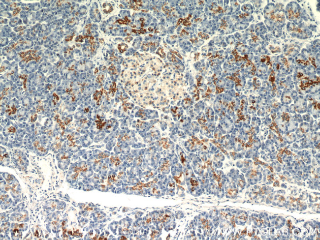 MAOA Antibody in Immunohistochemistry (Paraffin) (IHC (P))