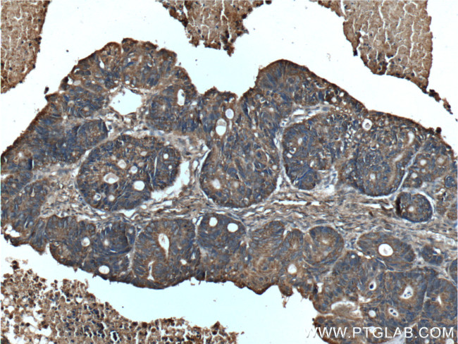 MAOA Antibody in Immunohistochemistry (Paraffin) (IHC (P))