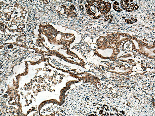 MAOA Antibody in Immunohistochemistry (Paraffin) (IHC (P))