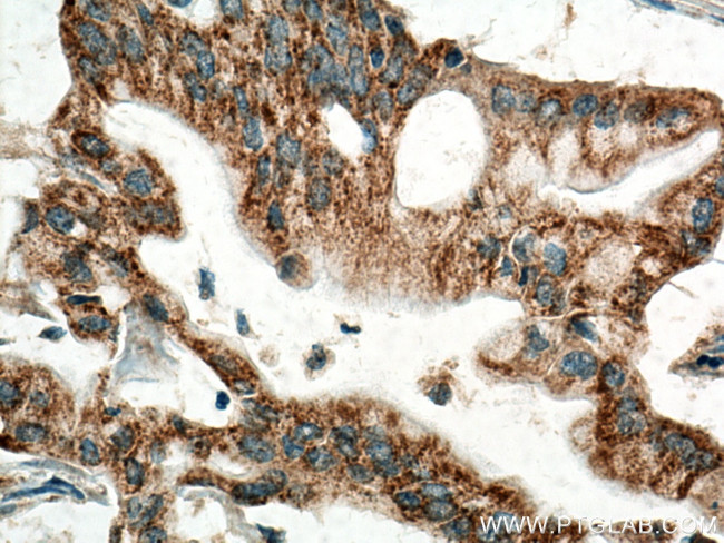 MAOA Antibody in Immunohistochemistry (Paraffin) (IHC (P))