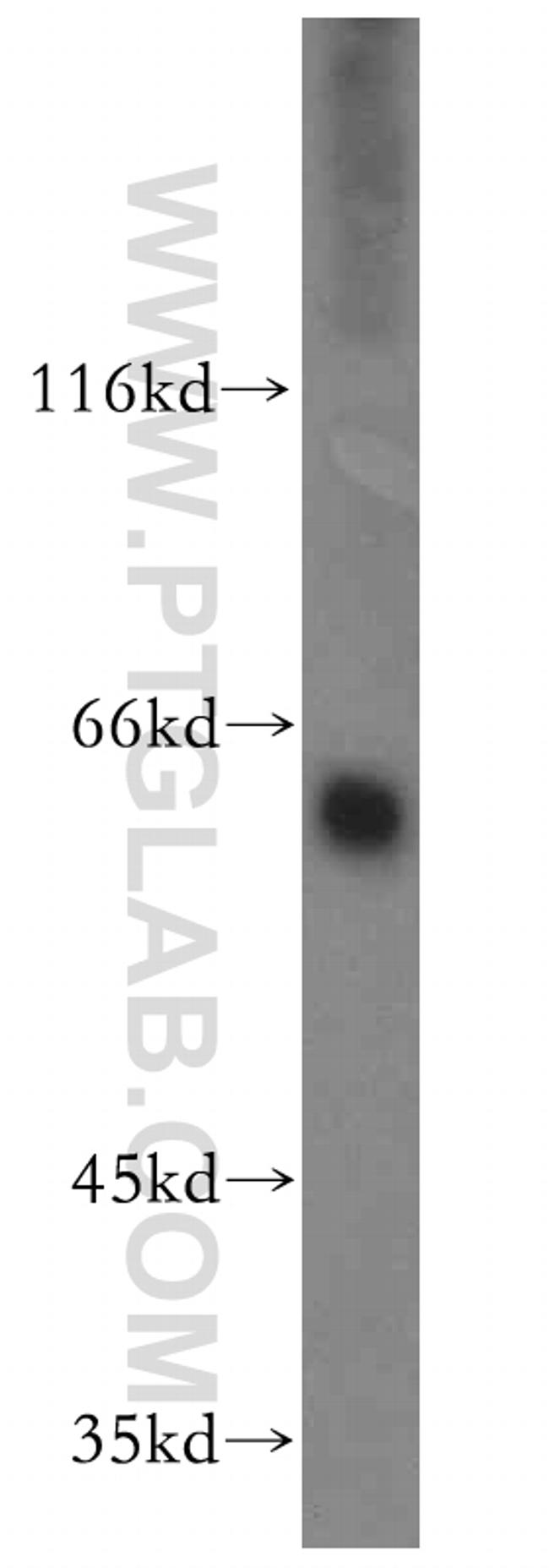 MAOA Antibody in Western Blot (WB)