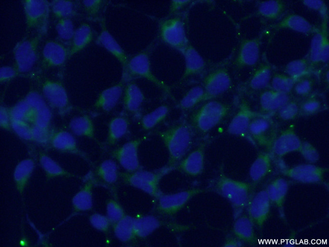 RABAC1 Antibody in Immunocytochemistry (ICC/IF)