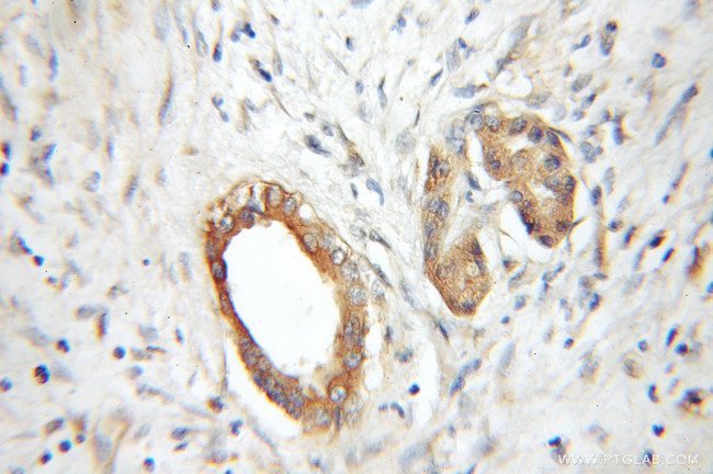 RABAC1 Antibody in Immunohistochemistry (Paraffin) (IHC (P))