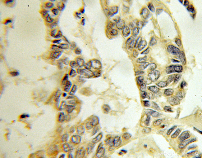 RABAC1 Antibody in Immunohistochemistry (Paraffin) (IHC (P))