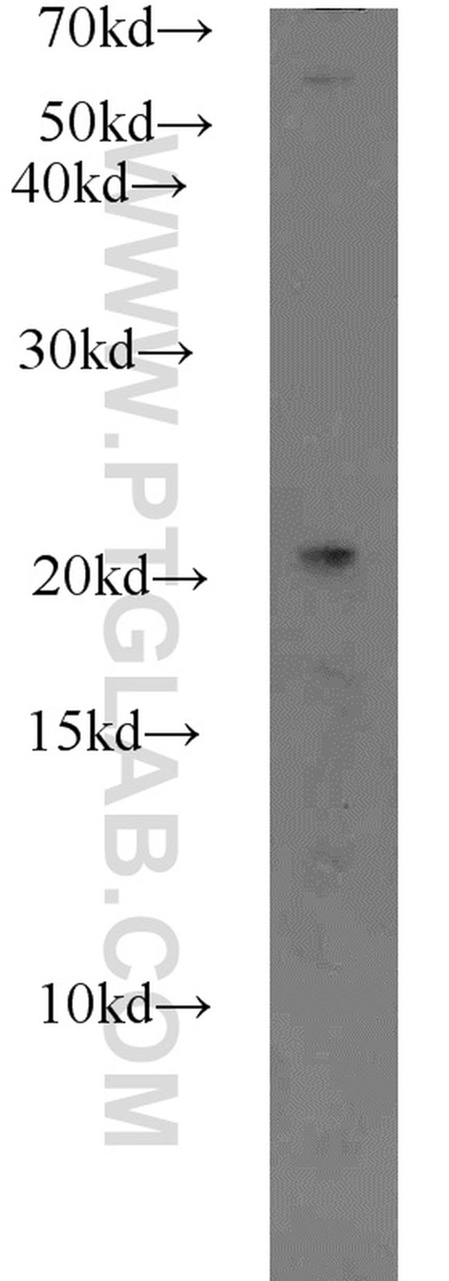 RABAC1 Antibody in Western Blot (WB)