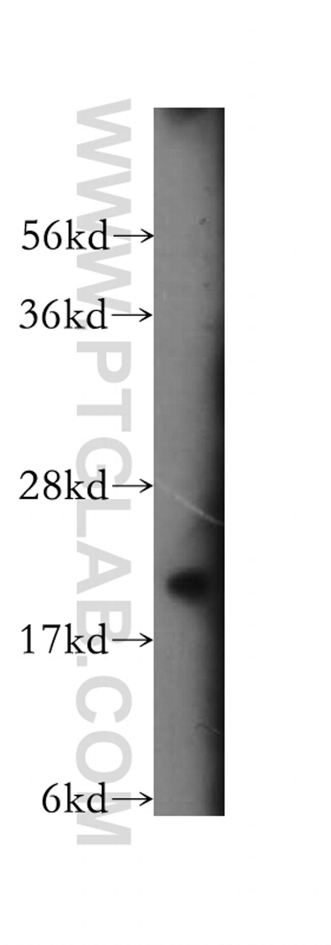 RABAC1 Antibody in Western Blot (WB)
