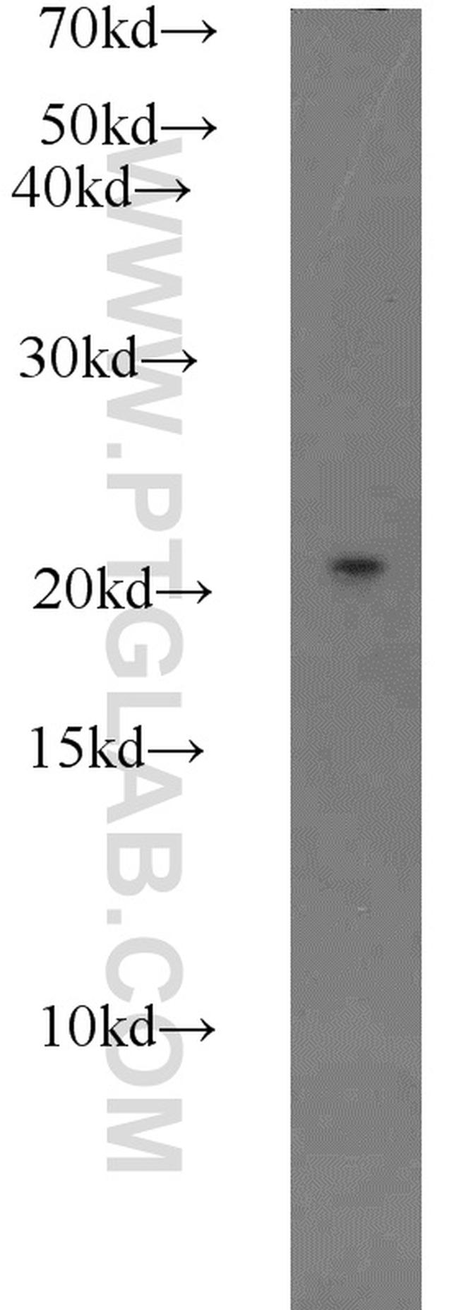 RABAC1 Antibody in Western Blot (WB)