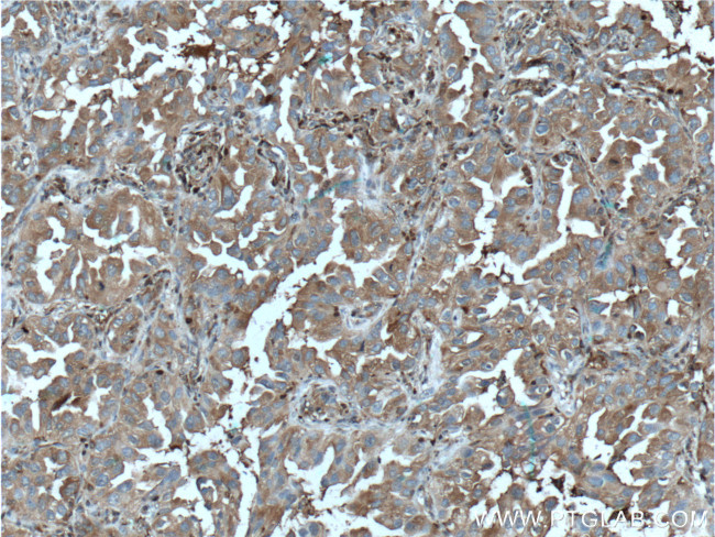 PSME1 Antibody in Immunohistochemistry (Paraffin) (IHC (P))