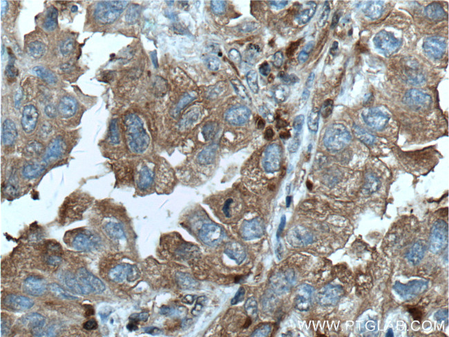 PSME1 Antibody in Immunohistochemistry (Paraffin) (IHC (P))