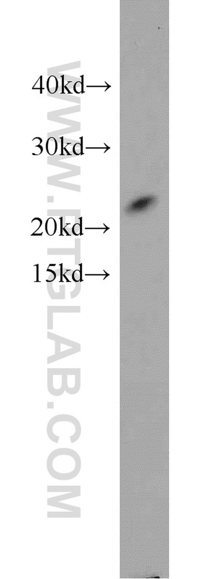 TAF9 Antibody in Western Blot (WB)