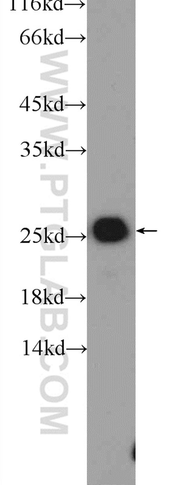 TAF9 Antibody in Western Blot (WB)