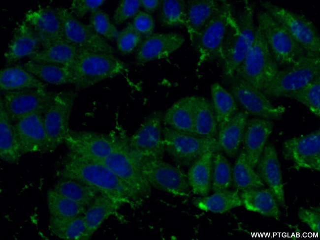 peroxiredoxin 2 Antibody in Immunocytochemistry (ICC/IF)