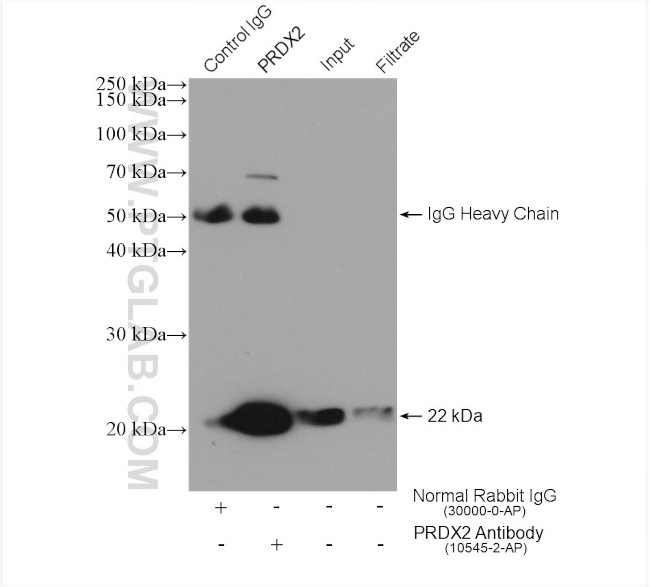 peroxiredoxin 2 Antibody in Immunoprecipitation (IP)