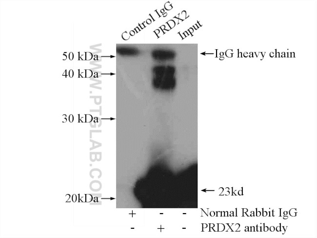 peroxiredoxin 2 Antibody in Immunoprecipitation (IP)