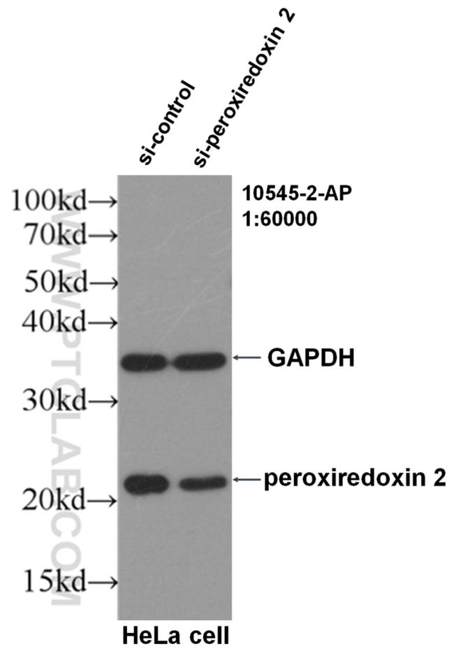 peroxiredoxin 2 Antibody in Western Blot (WB)