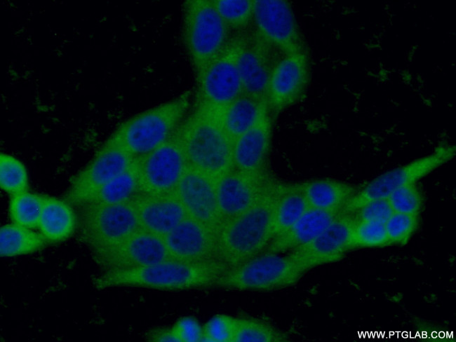 peroxiredoxin 2 Antibody in Immunocytochemistry (ICC/IF)