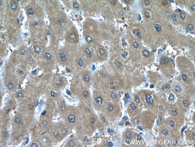 peroxiredoxin 2 Antibody in Immunohistochemistry (Paraffin) (IHC (P))