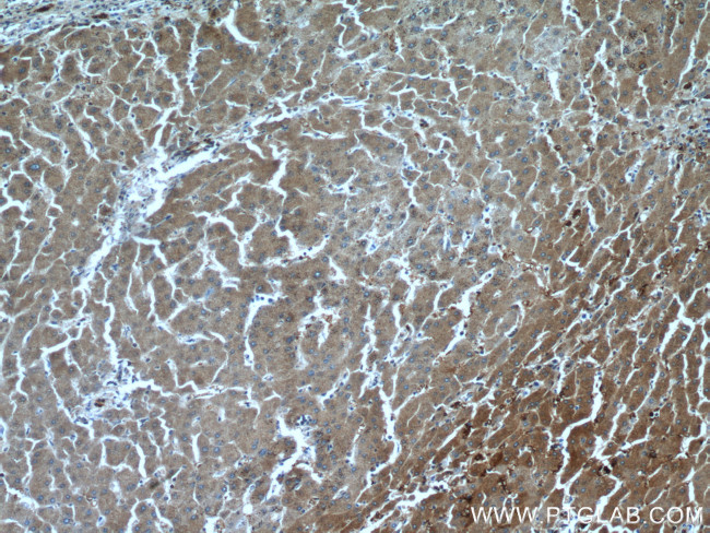 peroxiredoxin 2 Antibody in Immunohistochemistry (Paraffin) (IHC (P))