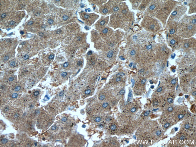 peroxiredoxin 2 Antibody in Immunohistochemistry (Paraffin) (IHC (P))