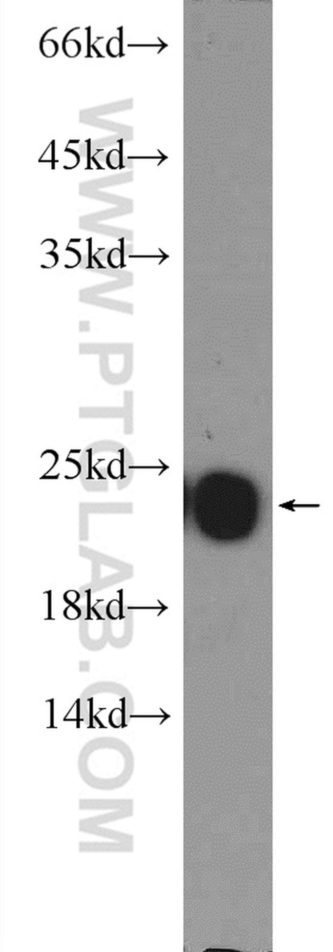 peroxiredoxin 2 Antibody in Western Blot (WB)