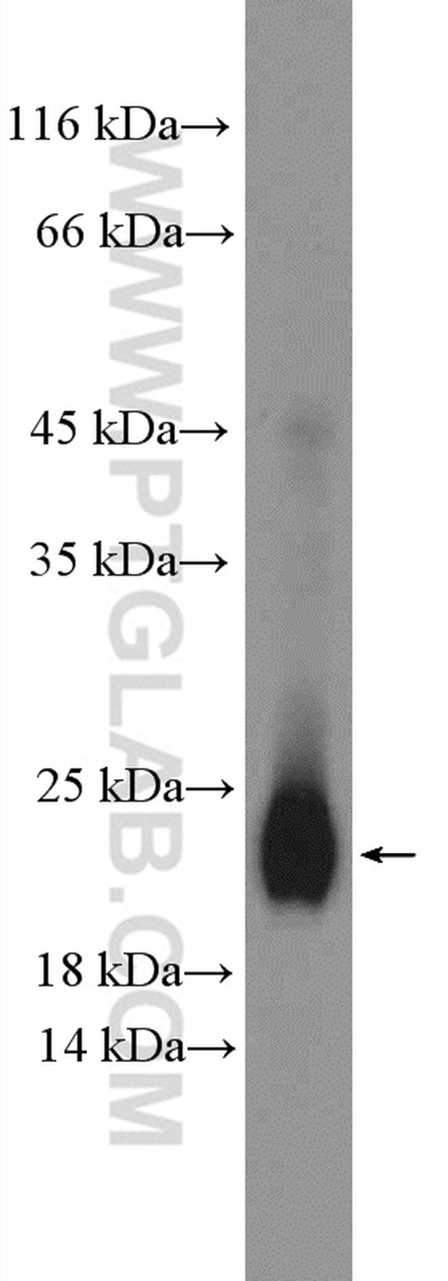 peroxiredoxin 2 Antibody in Western Blot (WB)