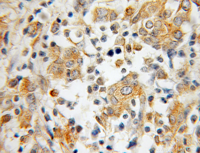 IRF5 Antibody in Immunohistochemistry (Paraffin) (IHC (P))