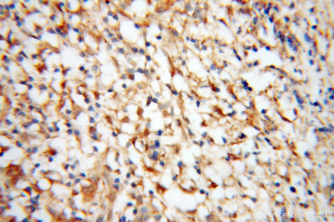 IRF5 Antibody in Immunohistochemistry (Paraffin) (IHC (P))