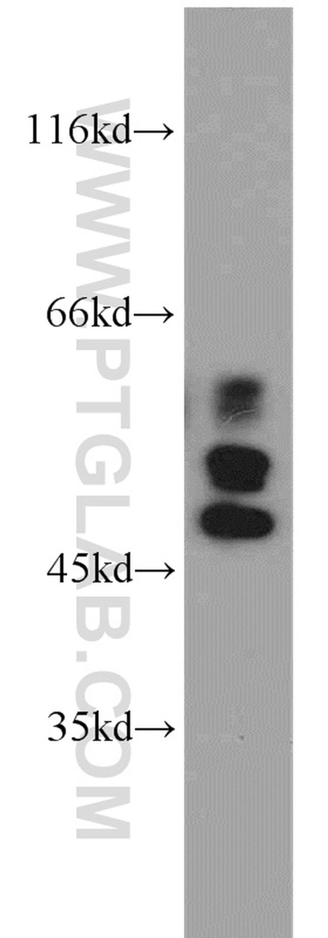 IRF5 Antibody in Western Blot (WB)