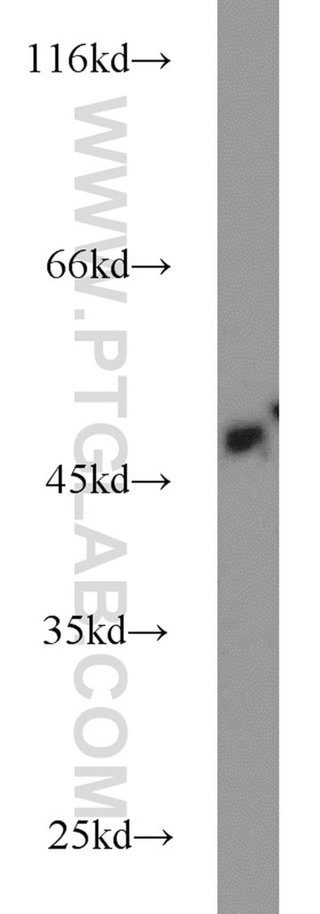 IRF5 Antibody in Western Blot (WB)