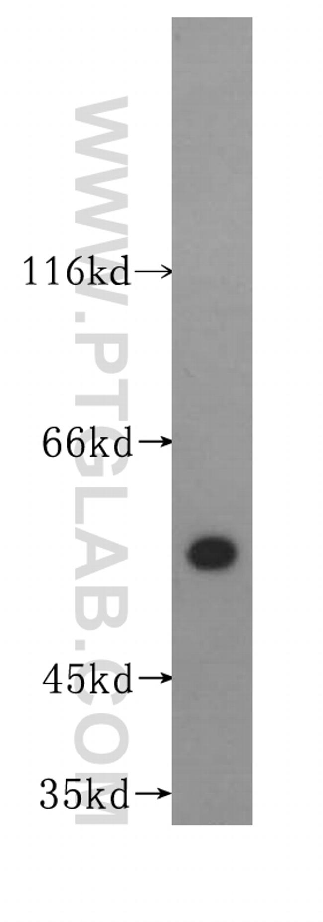 IRF5 Antibody in Western Blot (WB)