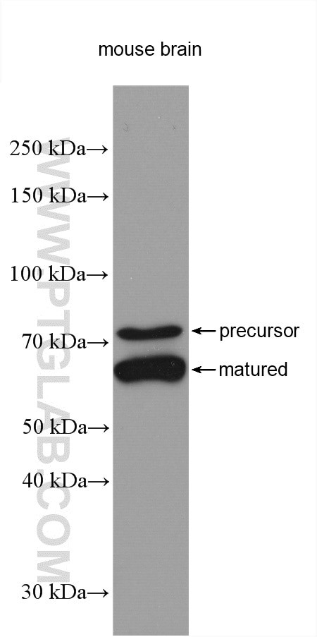 PCSK2 Antibody in Western Blot (WB)