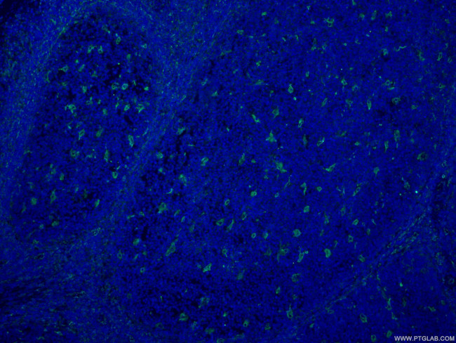 CD18 Antibody in Immunohistochemistry (PFA fixed) (IHC (PFA))