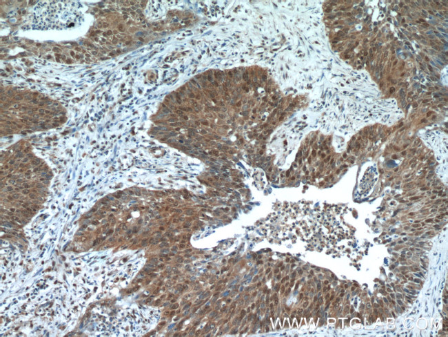 NCL Antibody in Immunohistochemistry (Paraffin) (IHC (P))