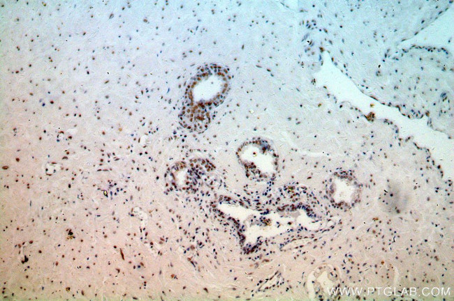 NCL Antibody in Immunohistochemistry (Paraffin) (IHC (P))