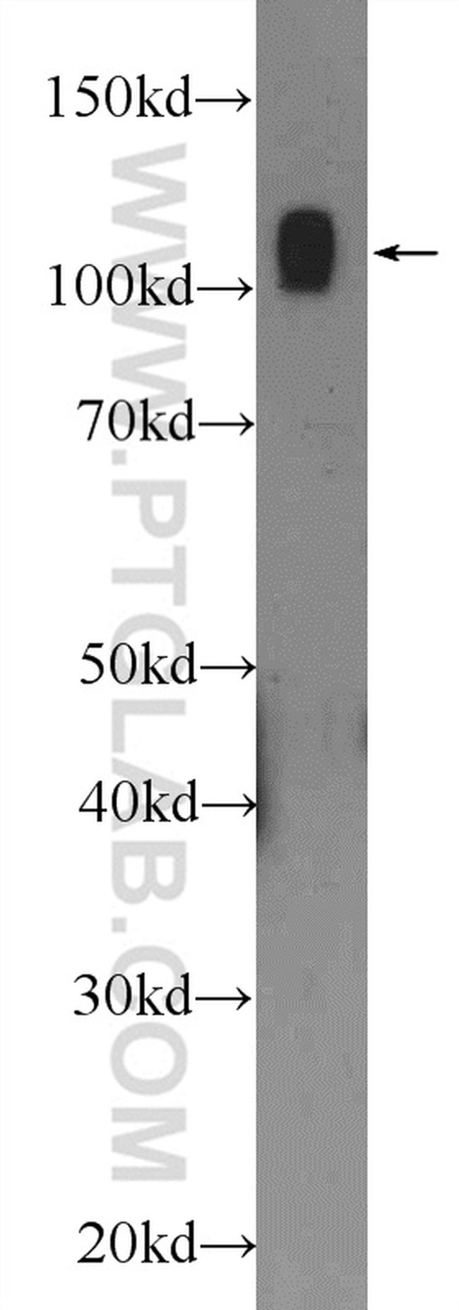 NCL Antibody in Western Blot (WB)