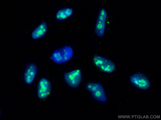 NCL Antibody in Immunocytochemistry (ICC/IF)