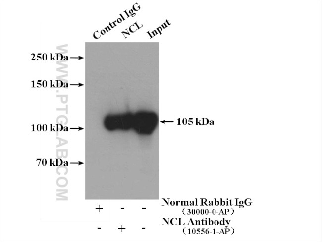 NCL Antibody in Immunoprecipitation (IP)